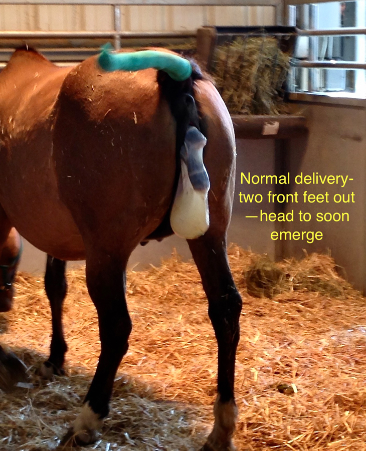 normal delivery